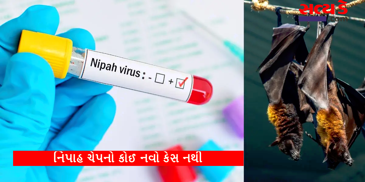 nipah virus 33