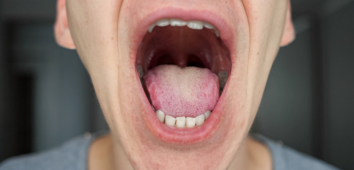 Tongue Cancer: શું સિગારેટ પીવાથી અને દારૂ પીવાથી જીભનું કેન્સર થઈ શકે છે?