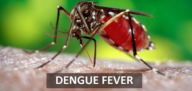 dengue fever