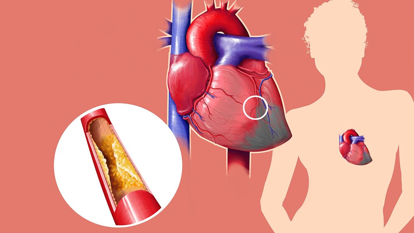 things you didnt know about cholesterol rm 1440x810 1