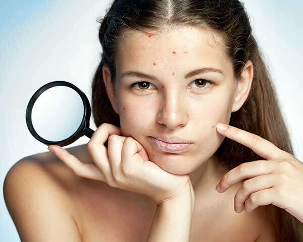 what causes pimple marks