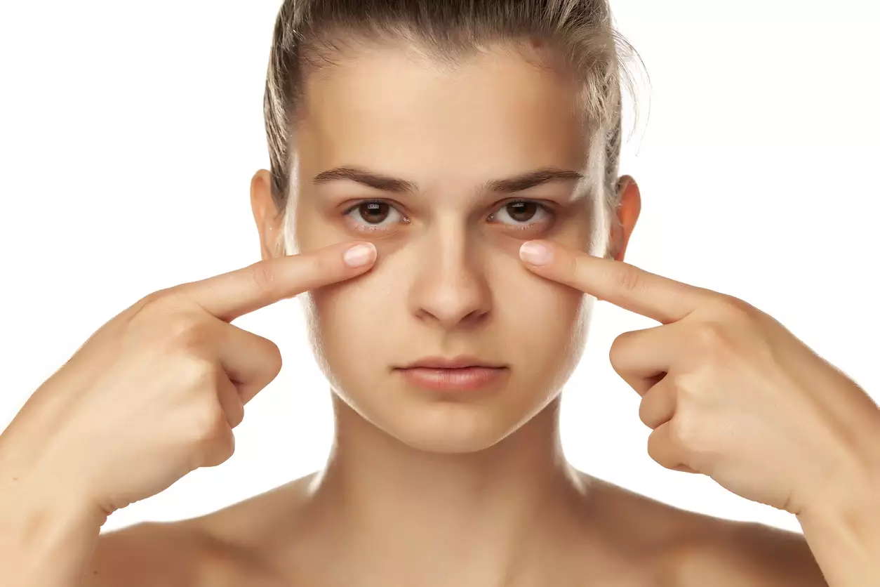 Troubled by dark circles So these methods will get rid in minutes